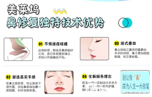 美萊塢鼻修復(fù)技術(shù)優(yōu)勢(shì) 美萊塢鼻修復(fù)技術(shù)優(yōu)勢(shì)
