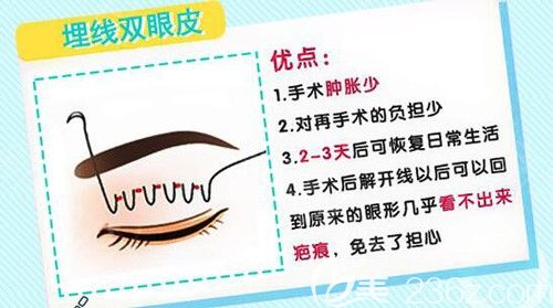 李晨霞醫(yī)生給我講述埋線雙眼皮的優(yōu)勢(shì) 李晨霞醫(yī)生給我講述埋線雙眼皮的優(yōu)勢(shì)