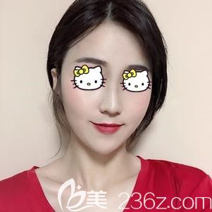 僅僅只是做了自體脂肪面部填充，就從被人厭棄的“寡婦臉”變成受人喜愛(ài)的