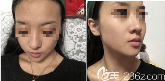 術(shù)前照片 術(shù)前照片