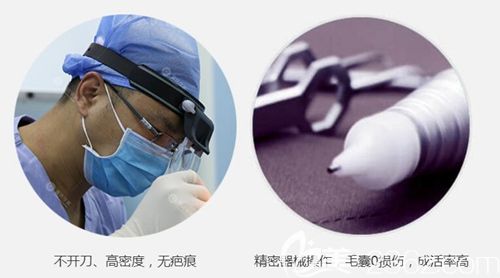 重慶華美植發(fā)技術(shù) 重慶華美植發(fā)技術(shù)