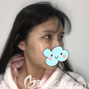 在太原時光做自體脂肪豐額頭術(shù)前的自己 在太原時光做自體脂肪豐額頭術(shù)前的自己