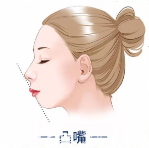 韓國(guó)菲斯萊茵凸嘴手術(shù)