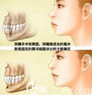 韓國(guó)菲斯萊茵用新思維模式打造新的手術(shù)模式