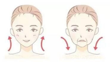 面部皮膚衰老下垂