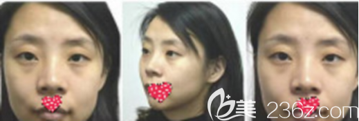 術(shù)前 術(shù)前