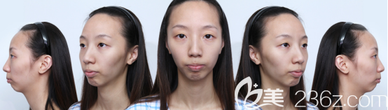 術(shù)前 術(shù)前