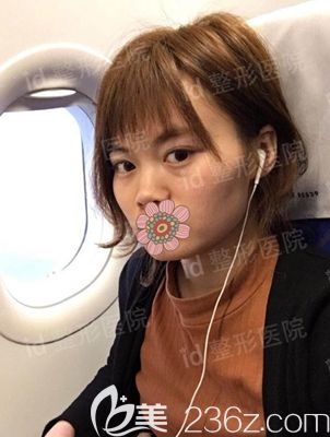 韓國id整形術前 韓國id整形術前