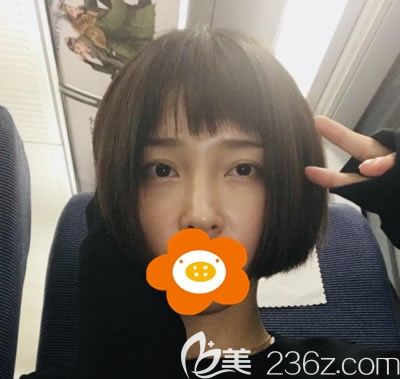 在福州比華利讓劉耀美為我做自體脂肪填充全臉時看到了填充額頭及淚溝的價格