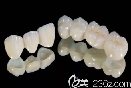全瓷牙圖片
