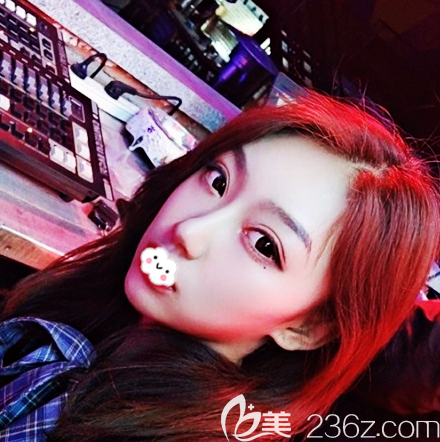 我找廣州韓妃牟北平做隆鼻子花了兩萬(wàn)多元感覺(jué)性?xún)r(jià)比很高醫(yī)生也很靠譜