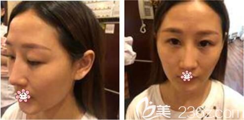 我的術(shù)前照片 我的術(shù)前照片