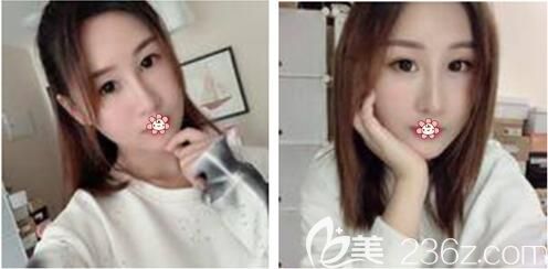 鄭楠醫(yī)生給我術(shù)后半個(gè)月 鄭楠醫(yī)生給我術(shù)后半個(gè)月