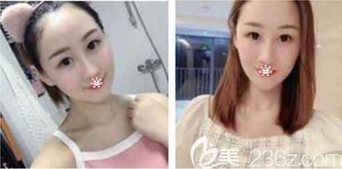 重慶美萊醫(yī)院正規(guī)嗎 重慶美萊醫(yī)院正規(guī)嗎