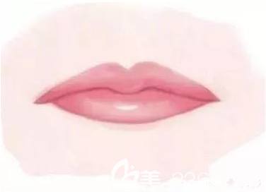 韓國原辰嘴角上揚手術(shù)