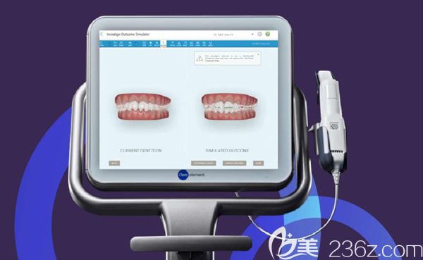 北京佳美口腔隱適美口掃儀器 北京佳美口腔隱適美口掃儀器