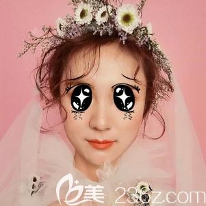 糾結(jié)鼻翼縮小術(shù)后越變?cè)酱?，不如看我在太原這家醫(yī)院術(shù)后68天的真實(shí)情況再考慮要不要手術(shù)