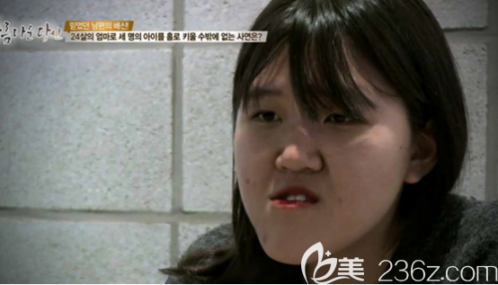 術(shù)前 術(shù)前