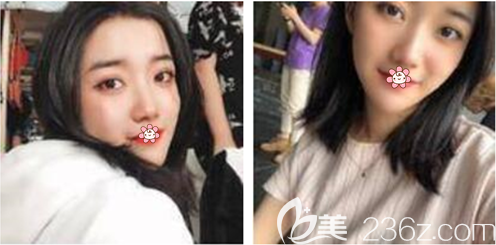 重慶美萊祛斑怎么樣 重慶美萊祛斑怎么樣