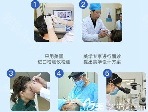 廣州碧蓮盛植發(fā)流程