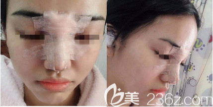 術(shù)后第三天