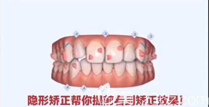 杭州齊爾口腔吳葉群正畸好嗎