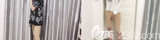 術(shù)后一個(gè)月