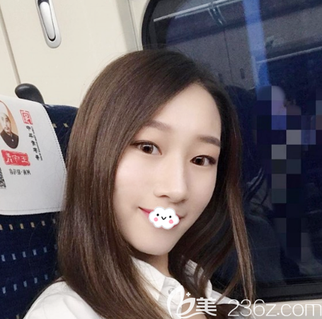 看了惠州去眼袋比較好的幾家醫(yī)院案例后去中信惠州醫(yī)院整形科找陳虹做了內(nèi)切去眼袋