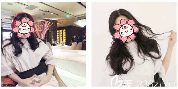 找廣州韓妃于洪瑞做隆胸術(shù)前照片 找廣州韓妃于洪瑞做隆胸術(shù)前照片