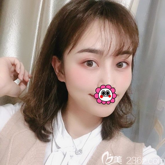 寧波薇琳自體脂肪面部填充<span style=