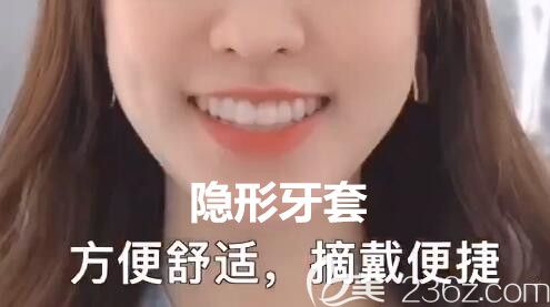 杭州齊爾口腔柯可醫(yī)生介紹隱形矯正