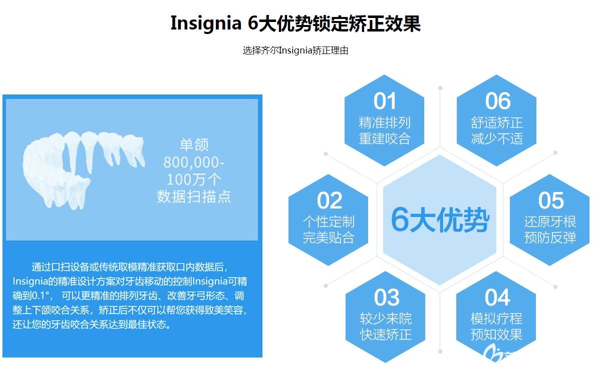 杭州齊爾口腔數(shù)字化正畸如何 杭州齊爾口腔數(shù)字化正畸如何