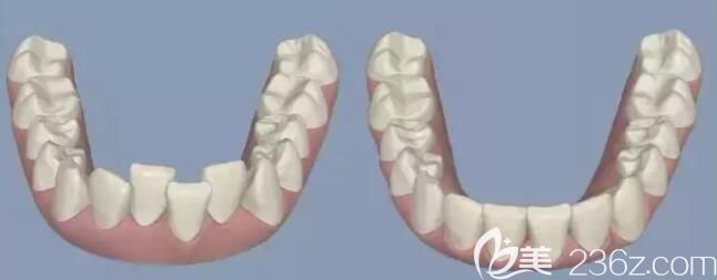 杭州齊爾口腔牙齒矯正怎么樣 杭州齊爾口腔牙齒矯正怎么樣