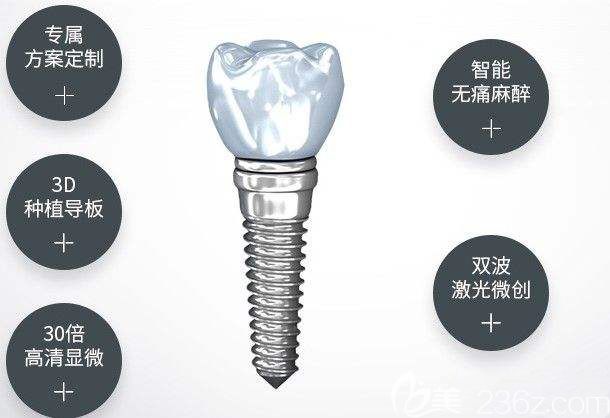 種植體結(jié)構(gòu)示意圖 種植體結(jié)構(gòu)示意圖