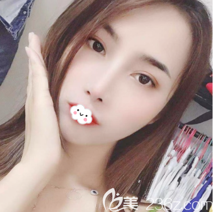 我看整形醫(yī)院口碑評(píng)價(jià)好收費(fèi)也不高就找陳星光做了雙眼皮找羅志敏做了鼻子