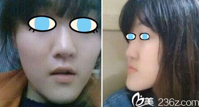 <!--<i data=20240703-sp></i>-->整形美容醫(yī)院做雙鄂手術案例