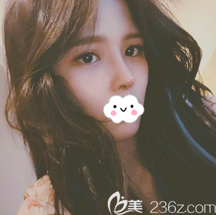 得知黃富偉是成都出名的做鼻子醫(yī)生后，我花4萬找他做了膨體隆鼻