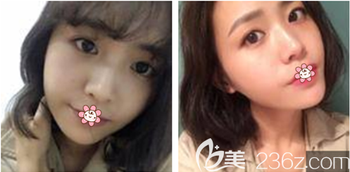 <!--<i data=20240703-sp></i>-->主任給我做完手術(shù)后10天 <!--<i data=20240703-sp></i>-->主任給我做完手術(shù)后10天