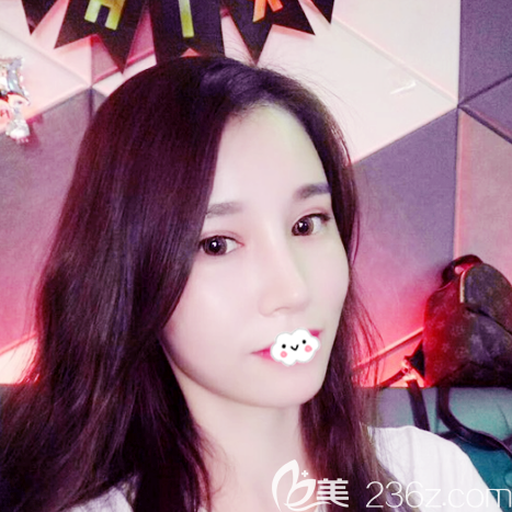 我能成功逆襲是因為找廣州藝美整形張濤做了自體脂肪全臉填充和雙眼皮隆鼻哦