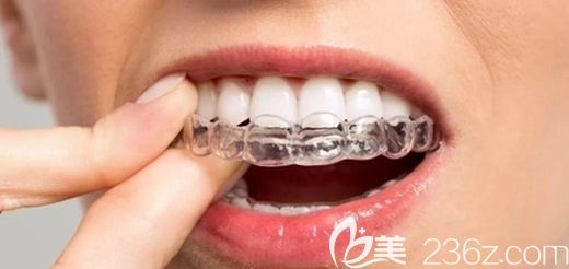 陸開盛院長談隱形牙套矯正的優(yōu)勢