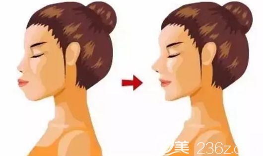 牙齒錯(cuò)頜畸形會(huì)影響面部發(fā)育