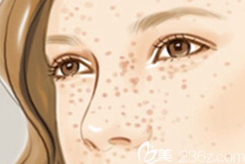 許昌博愛激光祛斑