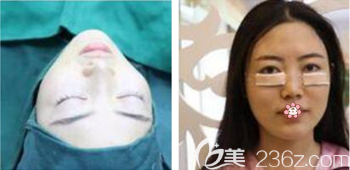 劉德東醫(yī)生給我手術(shù)的當(dāng)天 劉德東醫(yī)生給我手術(shù)的當(dāng)天