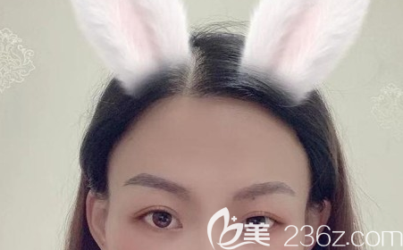 當初在重慶華膚植發(fā)際線植眉的時候我媽老是念叨我亂花錢，現(xiàn)在她終于改觀了