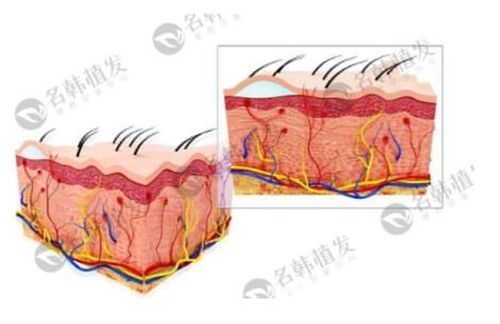 濟南名韓植發(fā)技術原理 濟南名韓植發(fā)技術原理