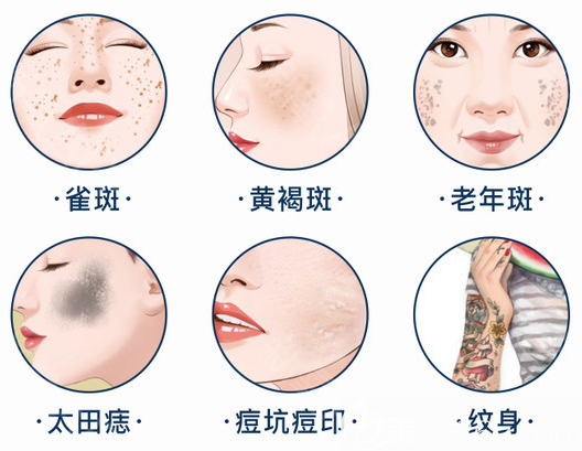 深圳美萊楊霞醫(yī)生擅長(zhǎng)項(xiàng)目介紹 深圳美萊楊霞醫(yī)生擅長(zhǎng)項(xiàng)目介紹