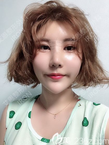 韓國艾恩鼻綜合術(shù)后第7天 韓國艾恩鼻綜合術(shù)后第7天