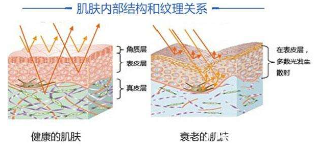 健康肌膚與衰老肌膚對(duì)比圖