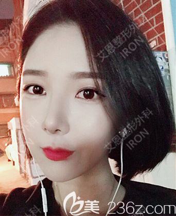 艾恩整形術(shù)后一個月 艾恩整形術(shù)后一個月