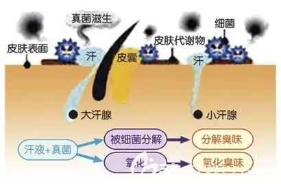 陳云娟分享腋臭產(chǎn)生原因 陳云娟分享腋臭產(chǎn)生原因